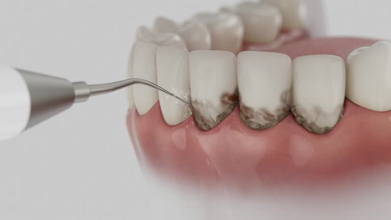 Reliable Root Canal Treatment contractor in Griggs County County, ND by Dentist Open Now